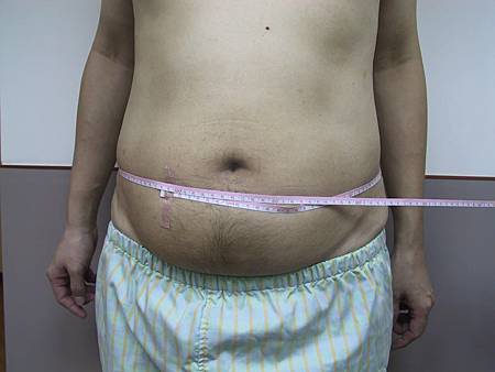 為整形名醫鄭孝威成功抽脂變身型男秘辛大公開 4 為整形名醫鄭孝威成功抽脂塑身秘辛大公開 3