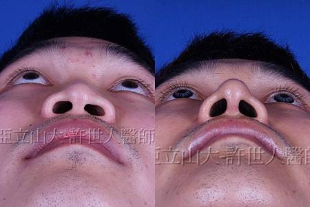 神啊!我也想變成Angela baby—談”明星臉整形”