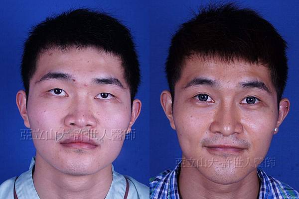 完美臉型，從下巴開始