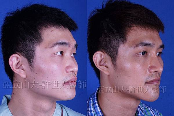 完美臉型，從下巴開始