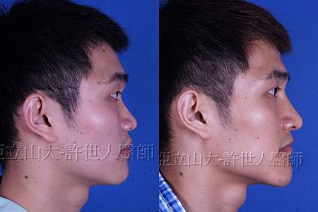 神啊!我也想變成Angela baby—談”明星臉整形”