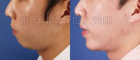 完美臉型，從下巴開始