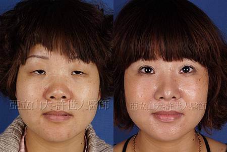 神啊!我也想變成Angela baby—談”明星臉整形”