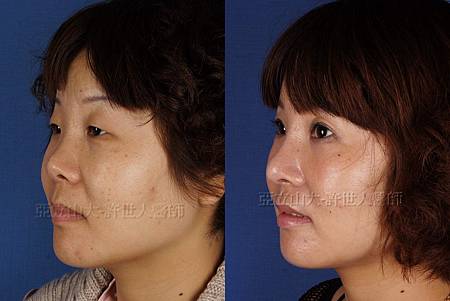 神啊!我也想變成Angela baby—談”明星臉整形”