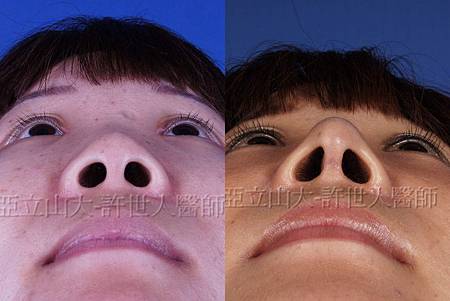 神啊!我也想變成Angela baby—談”明星臉整形”