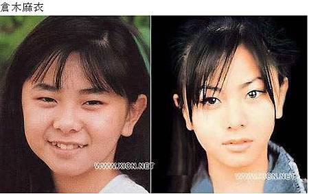 神啊!我也想變成Angela baby—談”明星臉整形”