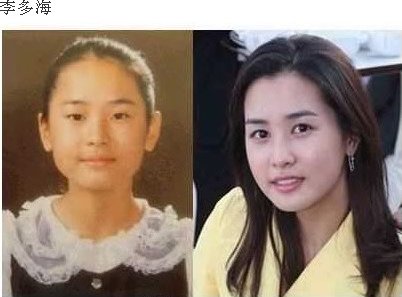 神啊!我也想變成Angela baby—談”明星臉整形”