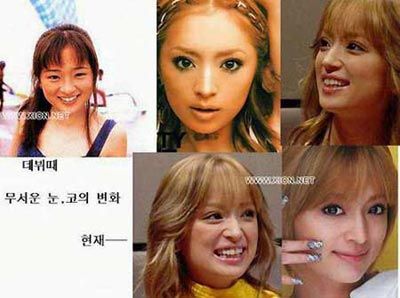 神啊!我也想變成Angela baby—談”明星臉整形”