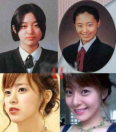 神啊!我也想變成Angela baby—談”明星臉整形”