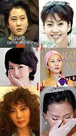 神啊!我也想變成Angela baby—談”明星臉整形”