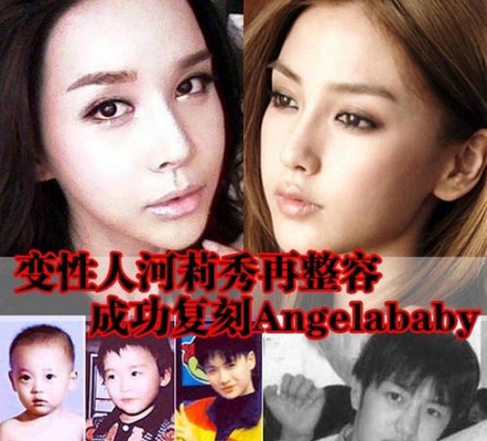 神啊!我也想變成Angela baby—談”明星臉整形”