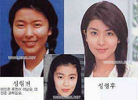 神啊!我也想變成Angela baby—談”明星臉整形”