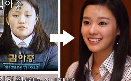 神啊!我也想變成Angela baby—談”明星臉整形”