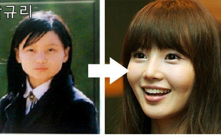 神啊!我也想變成Angela baby—談”明星臉整形”