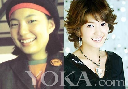 神啊!我也想變成Angela baby—談”明星臉整形”