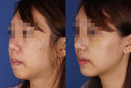 完美臉型，從下巴開始