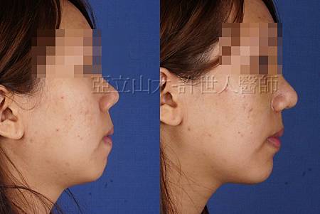 完美臉型，從下巴開始