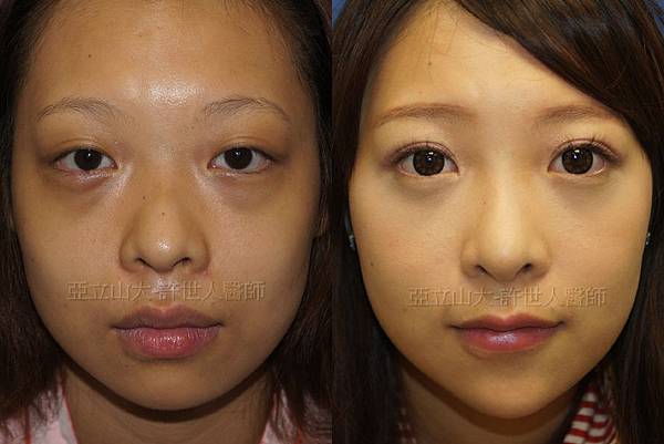 完美臉型，從下巴開始