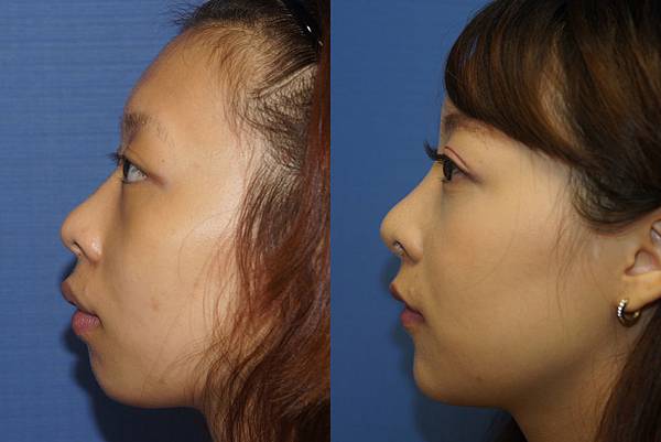 完美臉型，從下巴開始