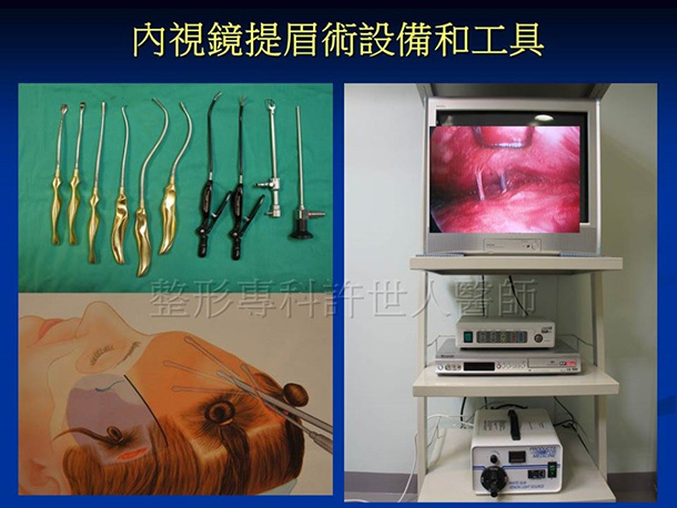 內視鏡提眉術設備和工具-1