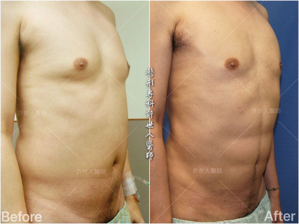六塊肌雕塑+腰腹環抽圖片-(2) 六塊肌雕塑+腰腹環抽圖片